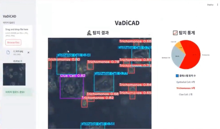 Trichomonas Detection